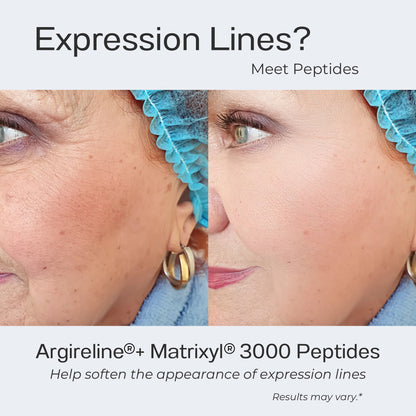 Advertisement for Argireline and Matrixyl 3000 Peptides showing a before and after effect on expression lines.