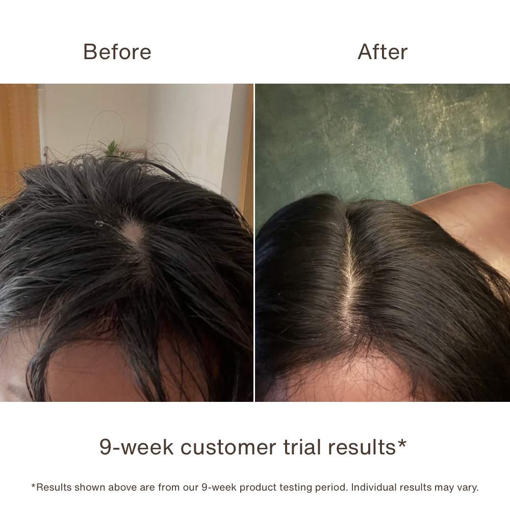 Dual Copper Peptide Hair Sérum | GHK-Cu + AHK-Cu Hair & Scalp Serum
